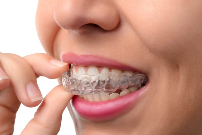 Image for A Smile Makeover Through Cosmetic Dentistry